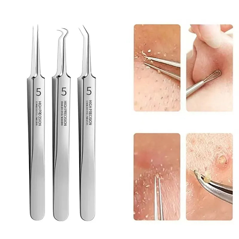 BowLift | Tweezer for Removing Blackheads on the Face