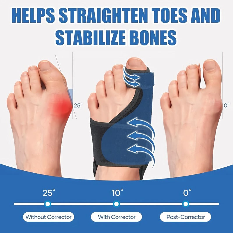 BowLift | Adjustable hallux valgus corrector