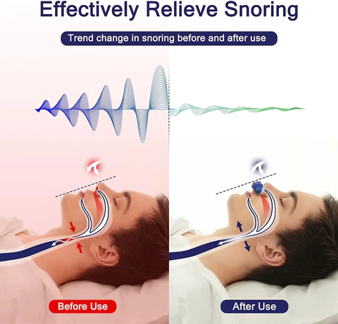 BowLift | Anti Snoring Nose Clip for Better Sleep