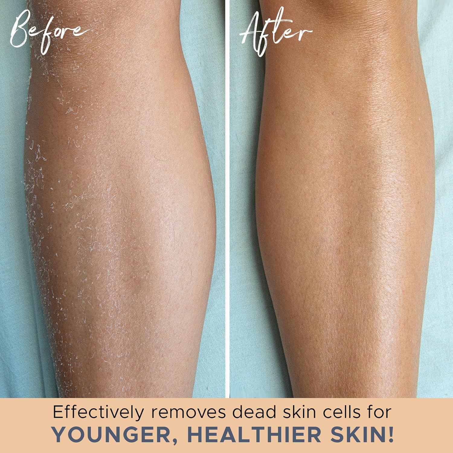 BowLift | Exfoliating Bath Gloves β Set of 2