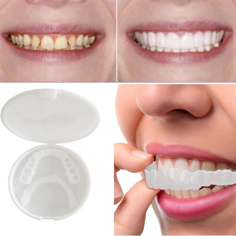 BowLift | PerfectSnap | Always the perfect smile