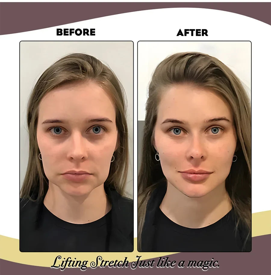 BowLift | Elastic Face Lifting Band