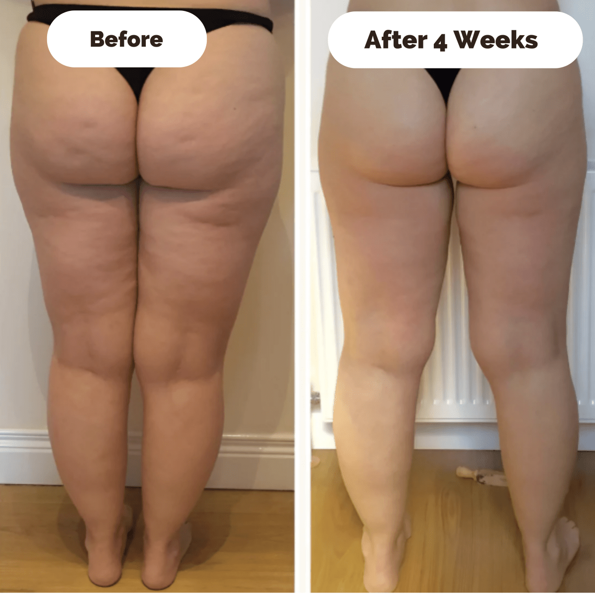 BowLift | DERMAGLOW – Skin-Firming Massage Device for Cellulite