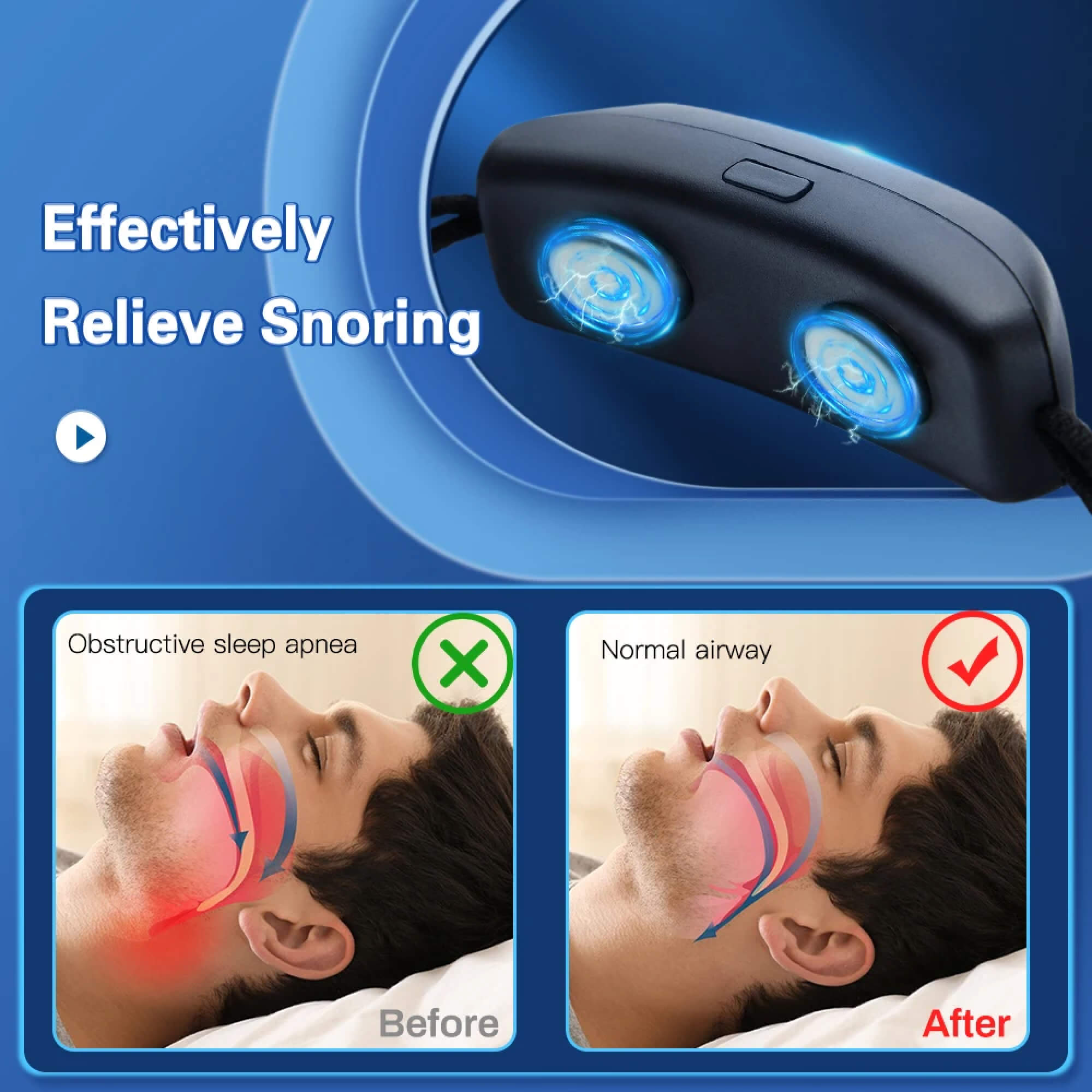 BowLift | Anti Snoring Stopper Prevent Snore Guard Device Chin Strap