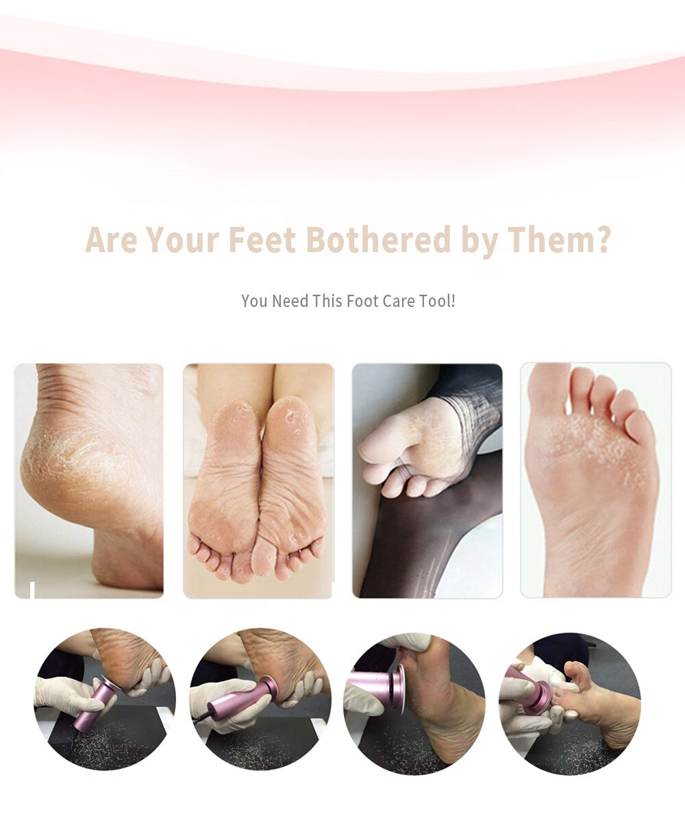 BowLift | Callus Remover - Foot Callus Remover