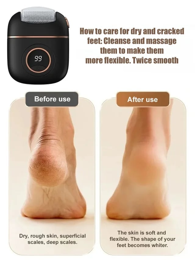 BowLift | 2025 New digital electric foot polishing machine