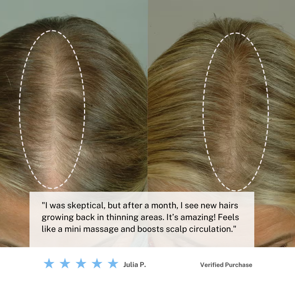 BowLift | Cordless Scalp Massaging Brush – Boost Hair Growth & Relax at Home