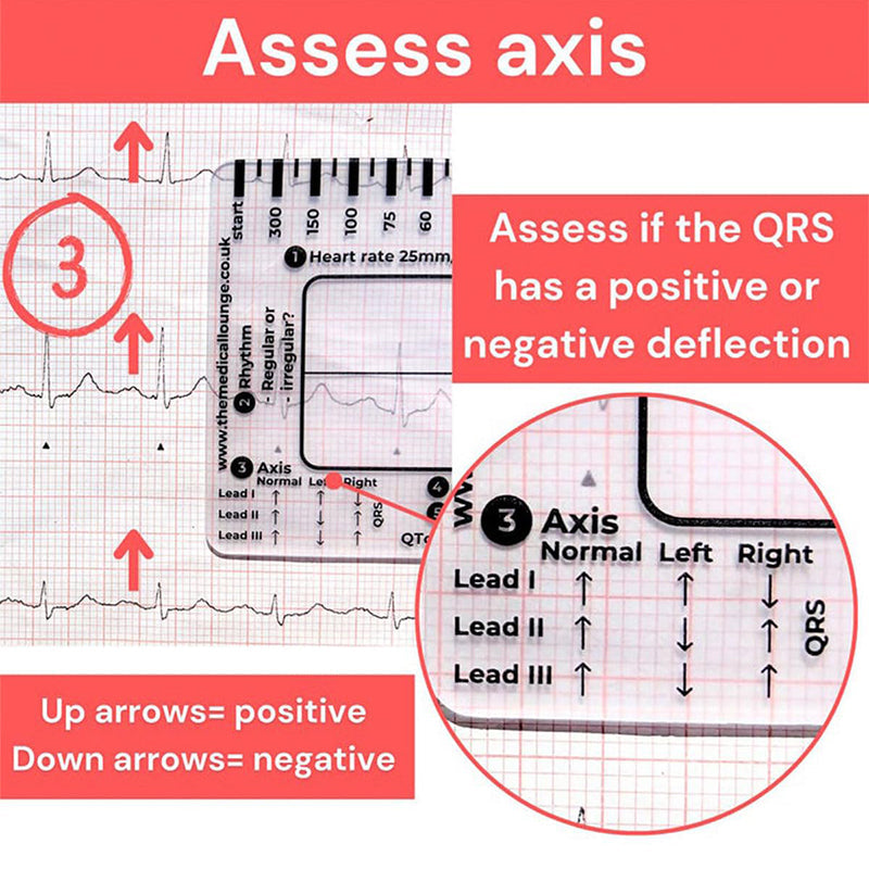 BowLift | ECG 7 Step Ruler