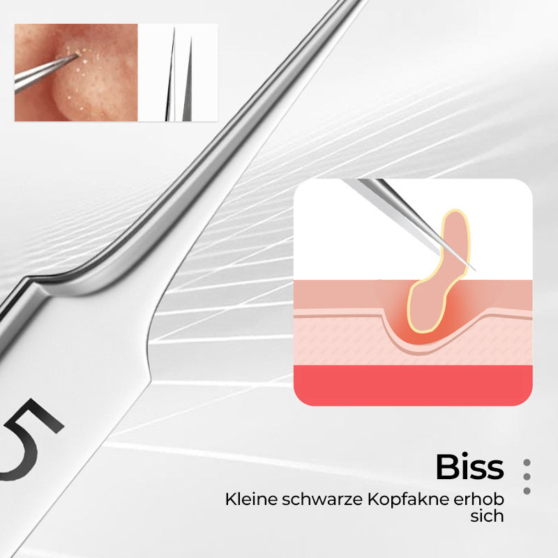 BowLift | Tweezer for Removing Blackheads on the Face