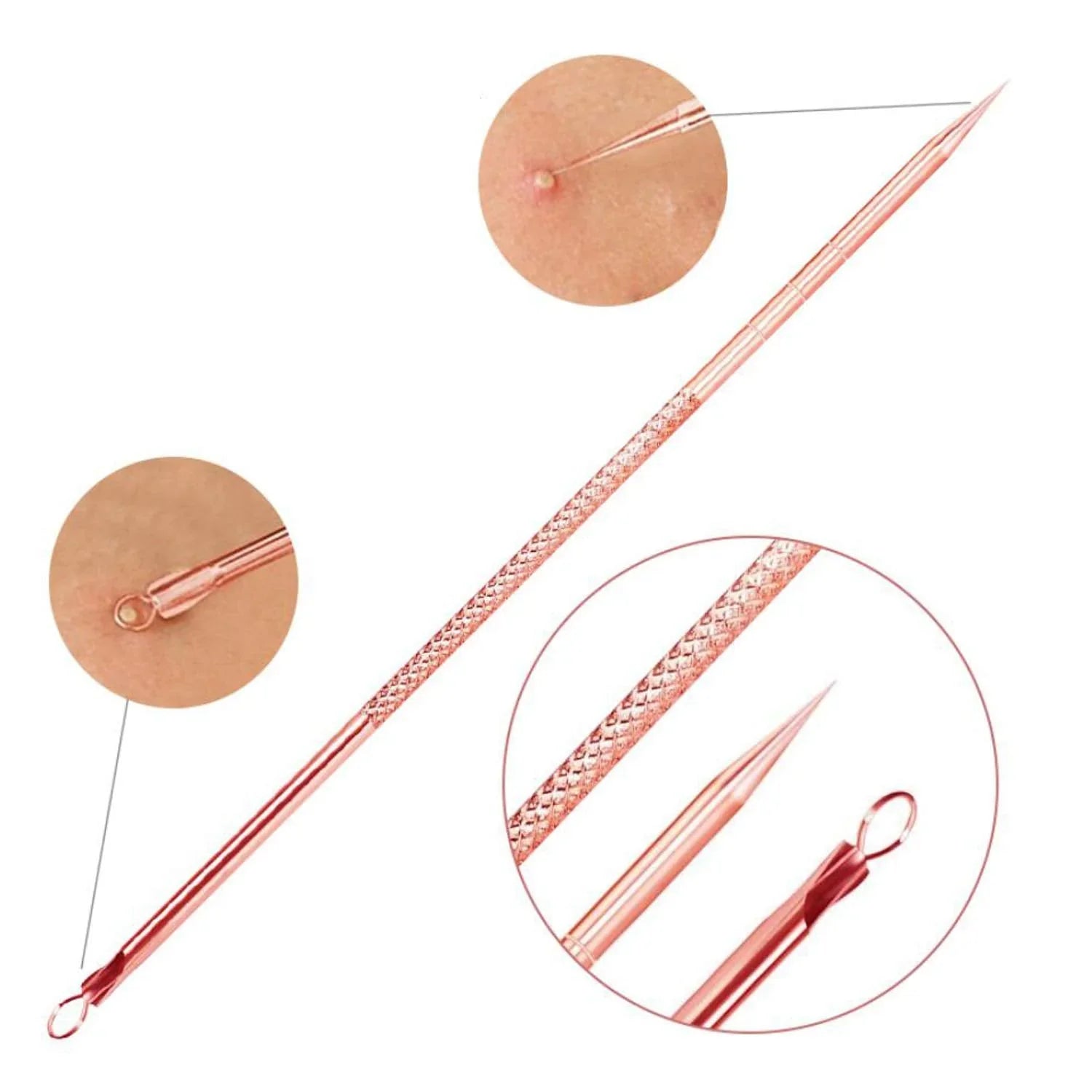 BowLift | Blackhead and pimple removal set