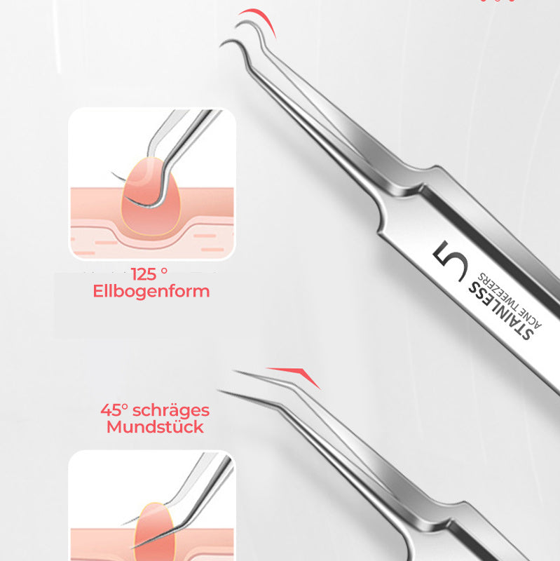 BowLift | Tweezer for Removing Blackheads on the Face