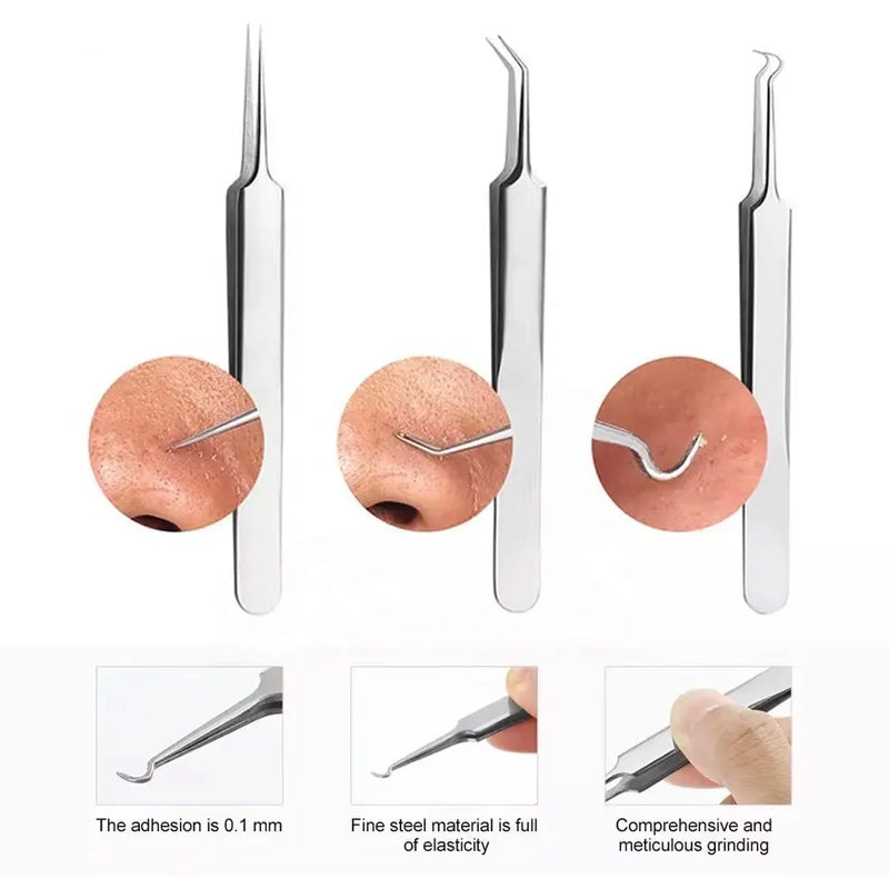 BowLift | Tweezer for Removing Blackheads on the Face