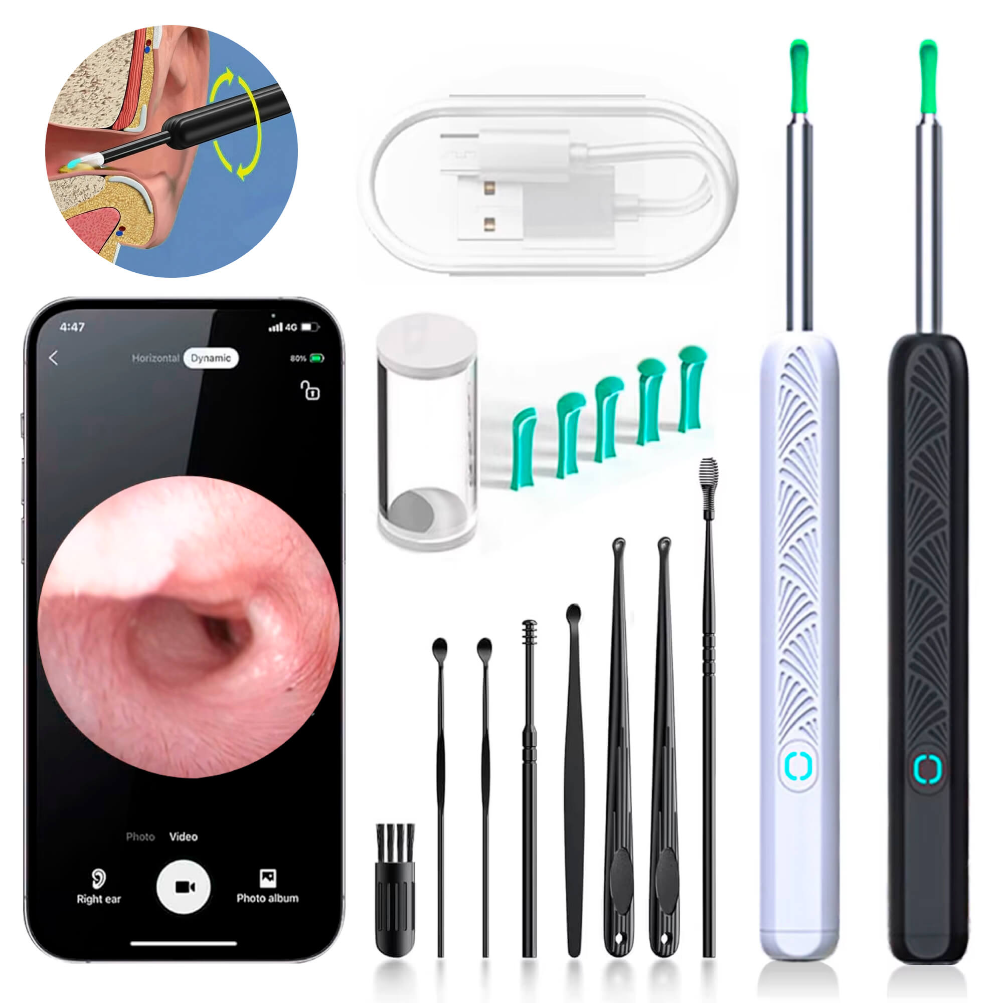 BowLift | EarScope Pro Ear Wax Removal Kit | High-Resolution Camera & LED Lights for Safe Home Use