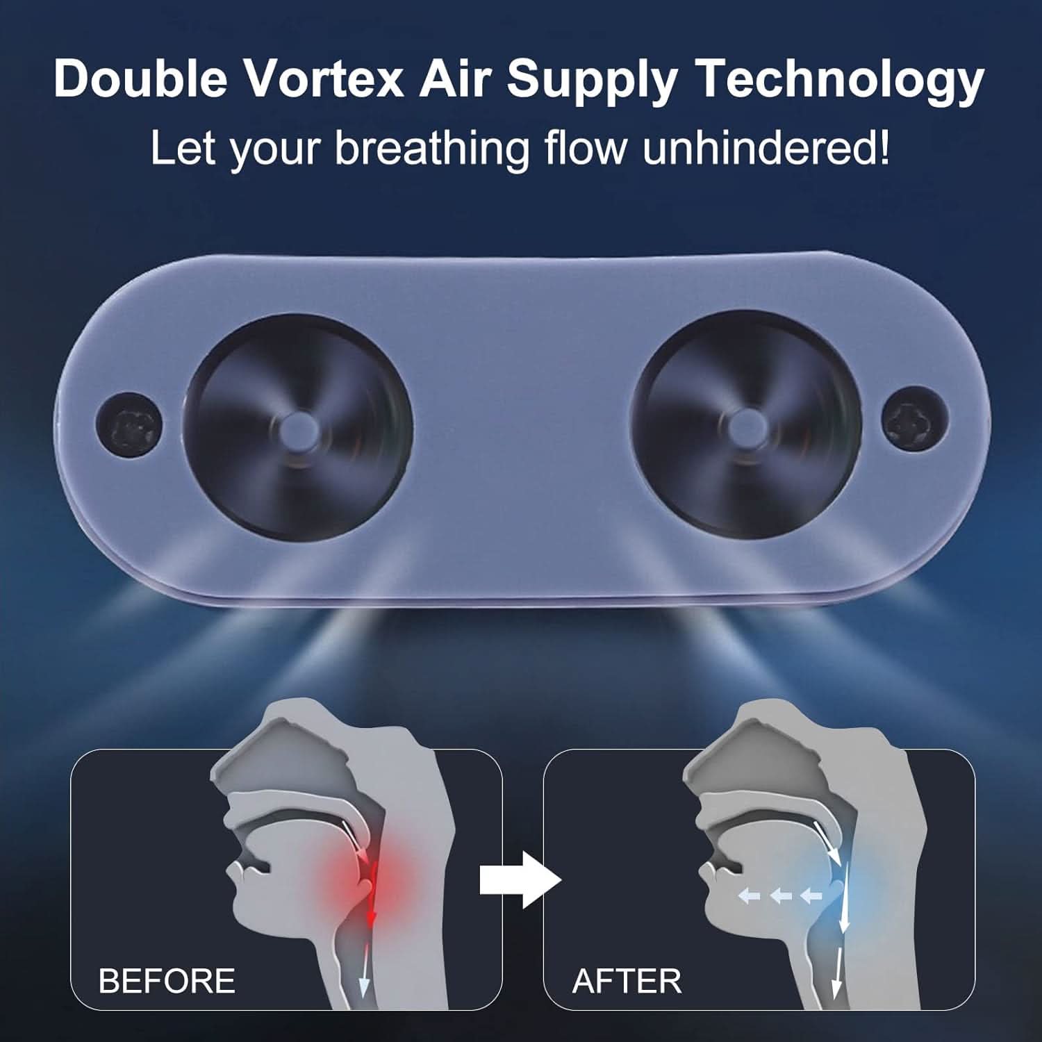 BowLift | Anti-Snoring CPAP Device without Mask for Quiet Sleep & Free Breathing