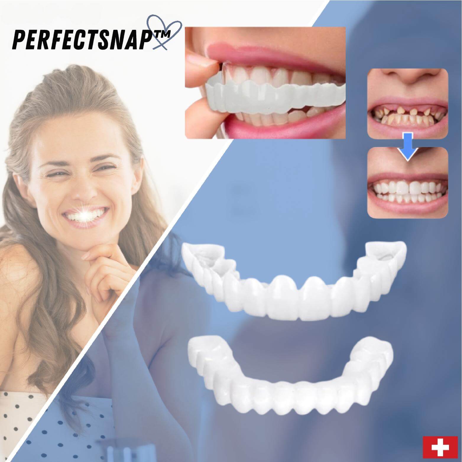 BowLift | PerfectSnap | Always the perfect smile