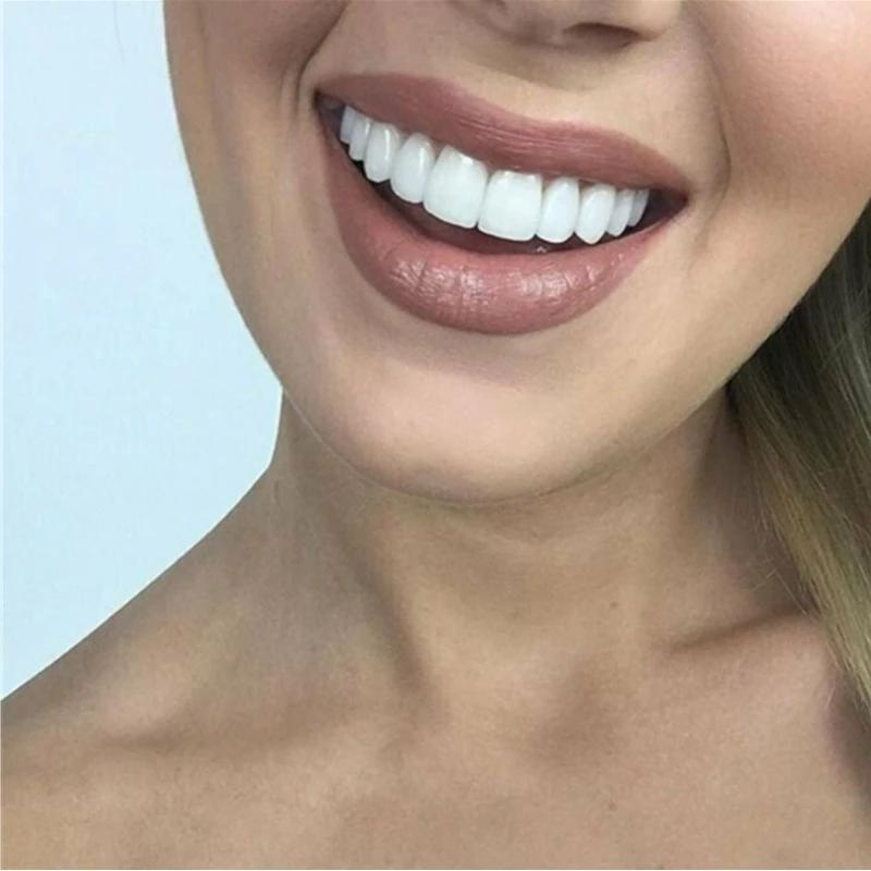 BowLift | PerfectSnap | Always the perfect smile
