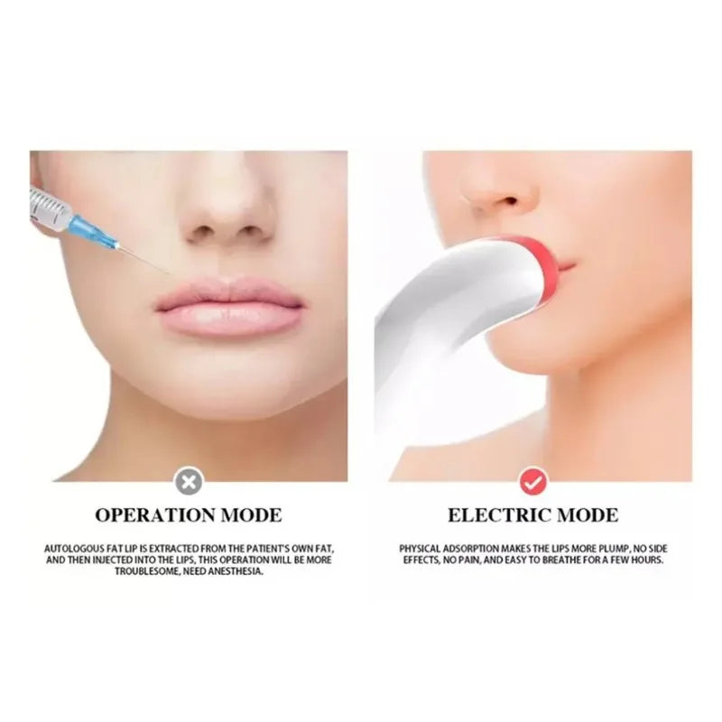BowLift | Electric Lip Enhancer Device