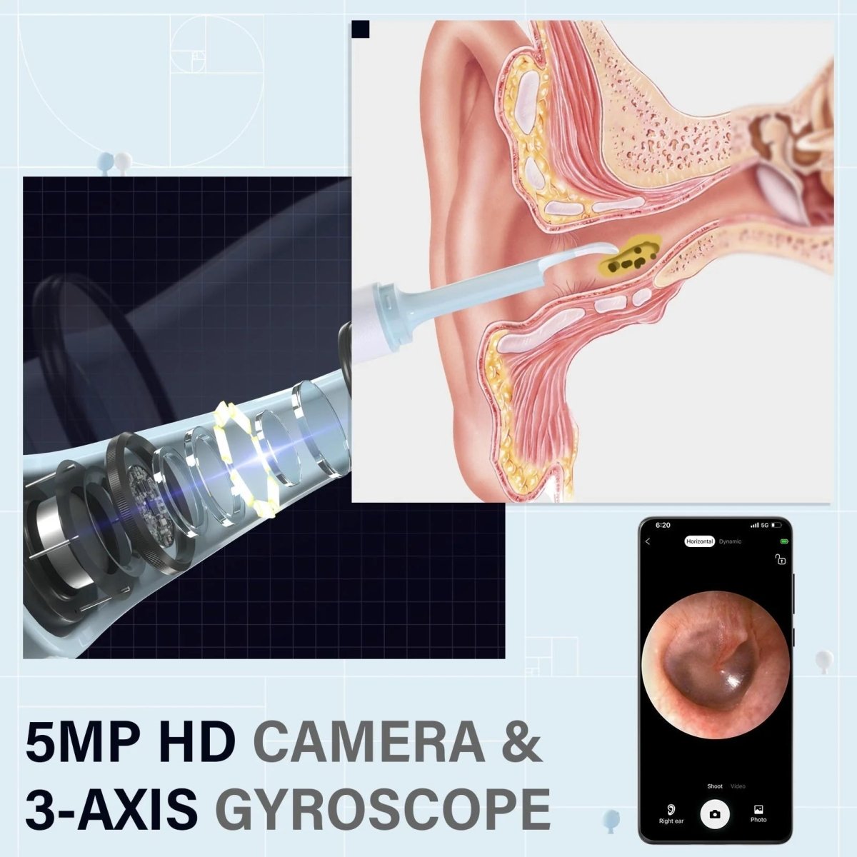 BowLift | AURIVIEW – Smart Ear Cleaner with HD Camera