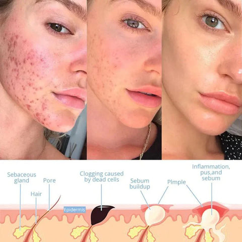 BowLift | Elysium Glow™ | Professional High-Frequency Facial Wand | Anti-Aging Skin Rejuvenation Device for Home Use & Spa Treatments