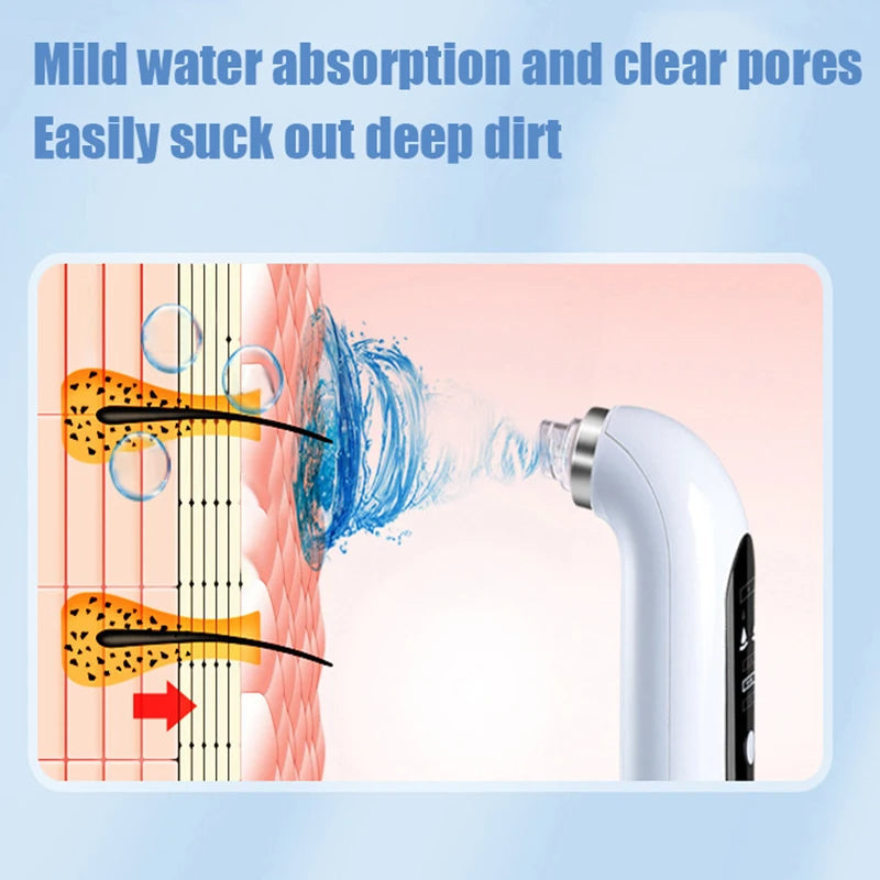BowLift | Professional Nose Blackhead Remover Vacuum - Deep Cleansing with Suction Technology