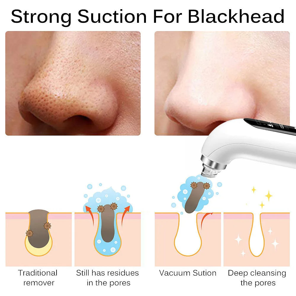 BowLift | Professional Nose Blackhead Remover Vacuum - Deep Cleansing with Suction Technology