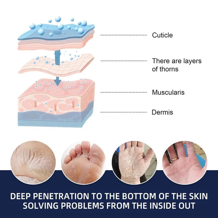 BowLift | Cracked Foot Heel Treatment Pack of 3