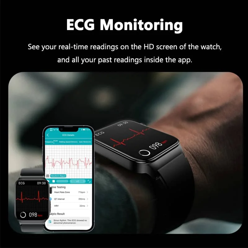 BowLift | All-in-One Health Monitoring Smartwatch with ECG & Blood Glucose Tracker