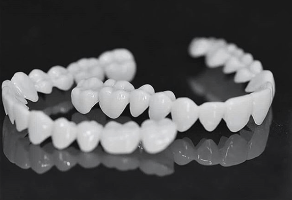 BowLift | FLEXIDENT – Natural-Look Dental Veneer for Everyday Confidence